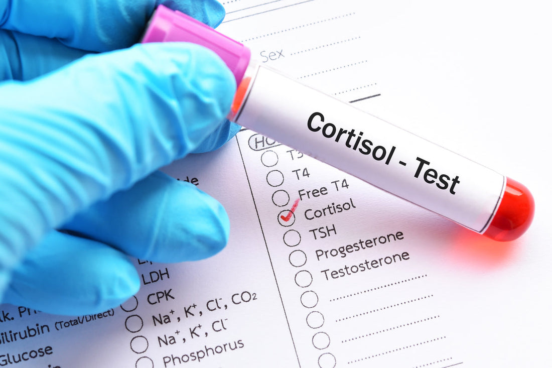 CBD Lowers Cortisol